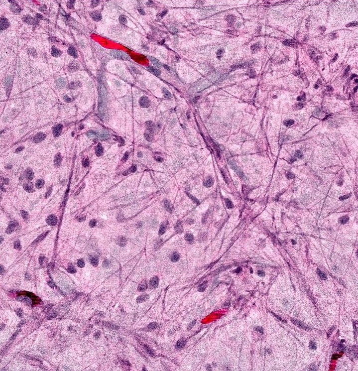 Intraoperative virtual histology